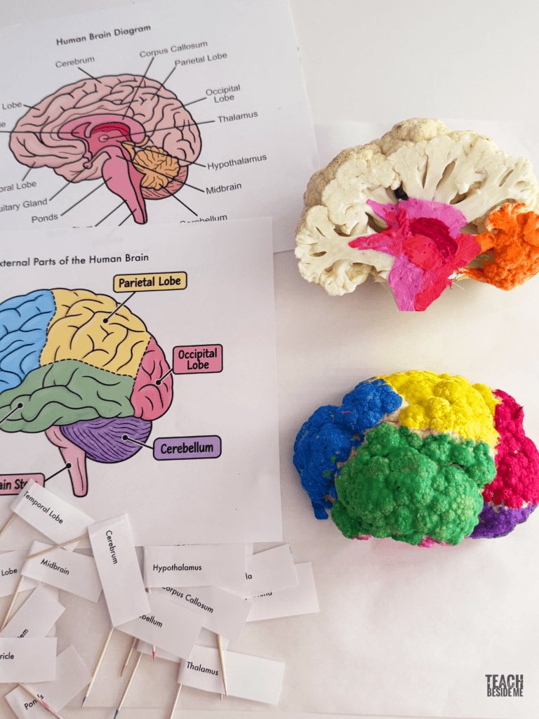 3d brain model with cauliflower